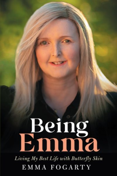 Being Emma : Living My Best Life with Butterfly Skin by Fogarty, Emma